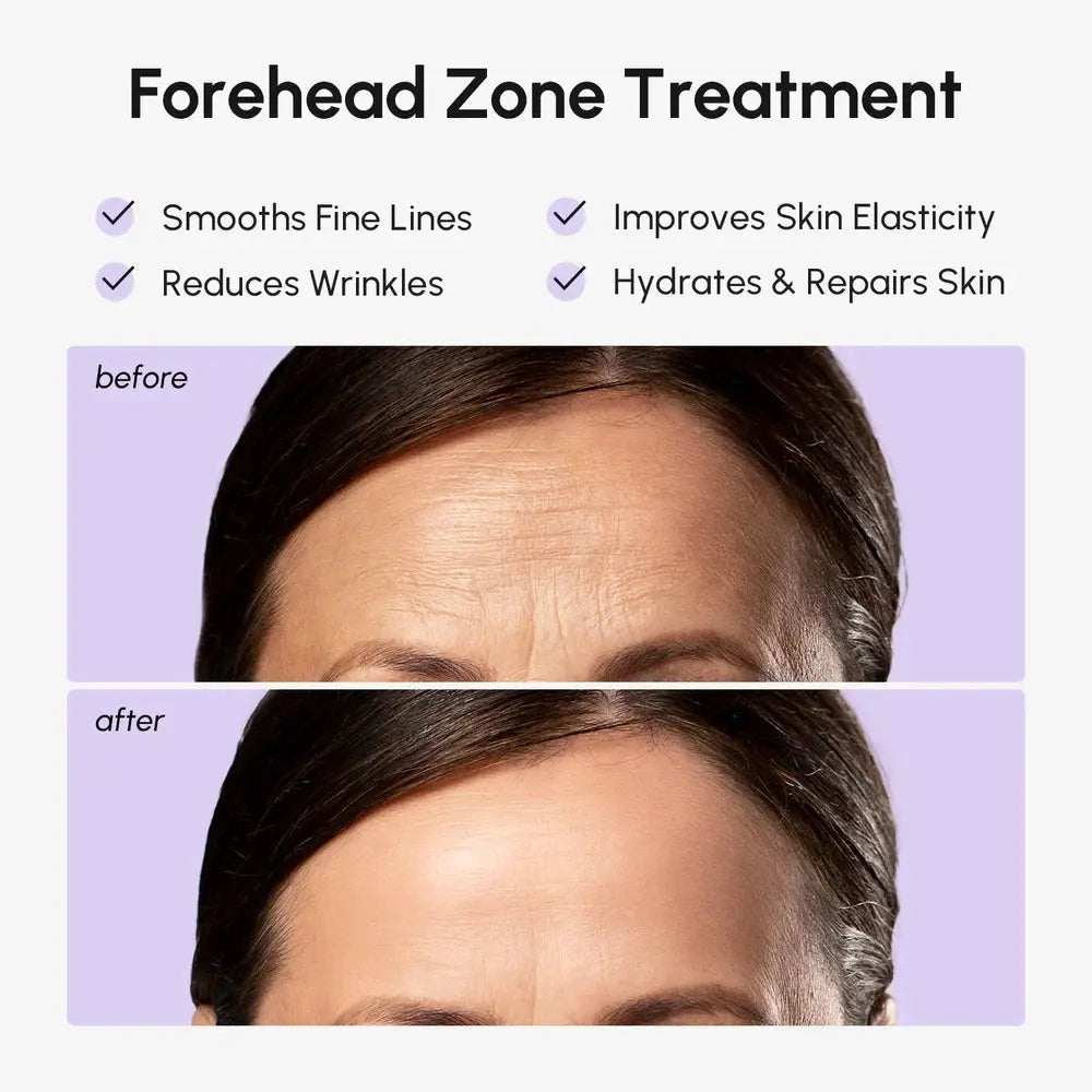 Anti-Wrinkle Forehead Patches - Real Deal